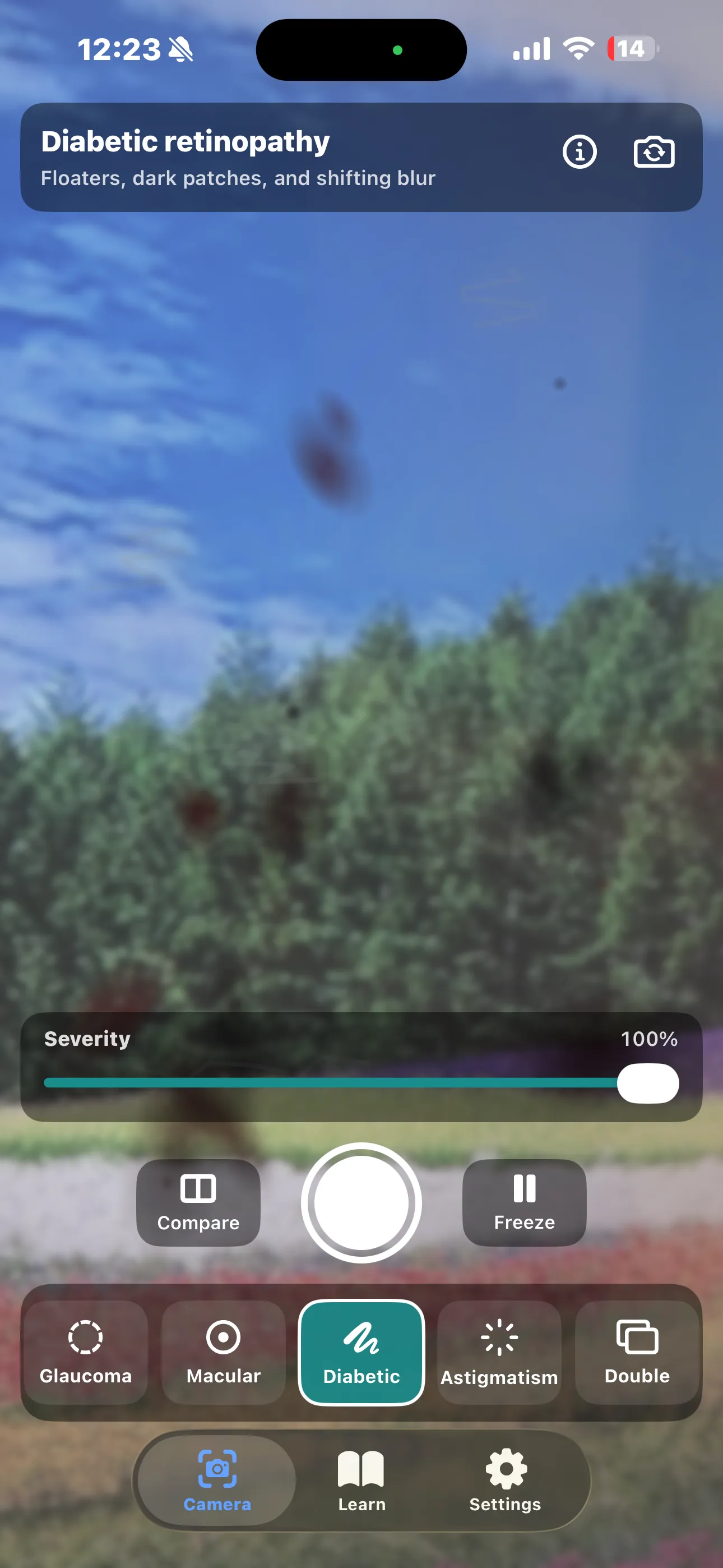 Diabetic retinopathy simulation — dark haemorrhage blotches and thread-like floaters drifting over a softly blurred scene