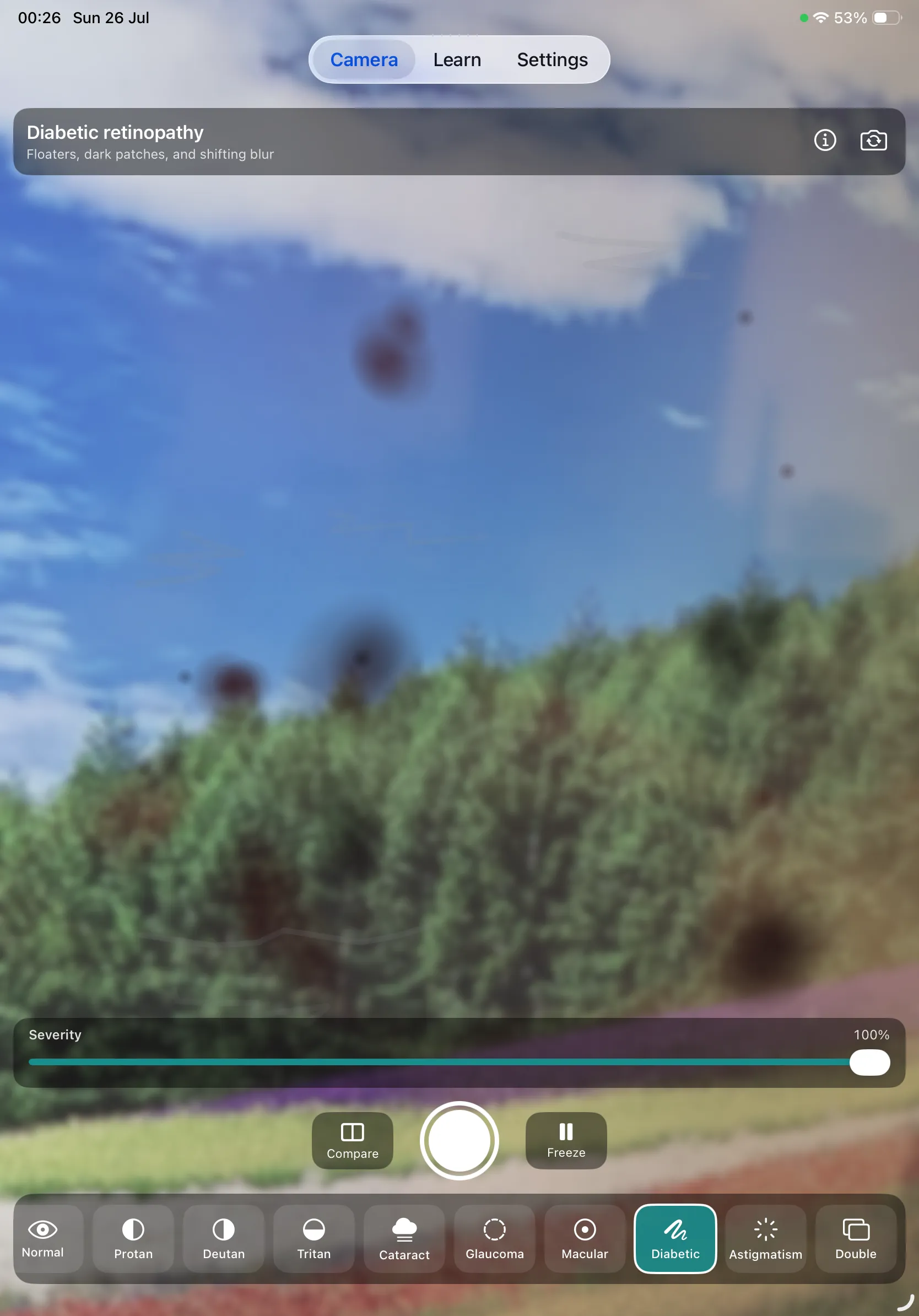 Color Blind Cam on iPad — diabetic retinopathy with haemorrhage blotches and floaters across the view