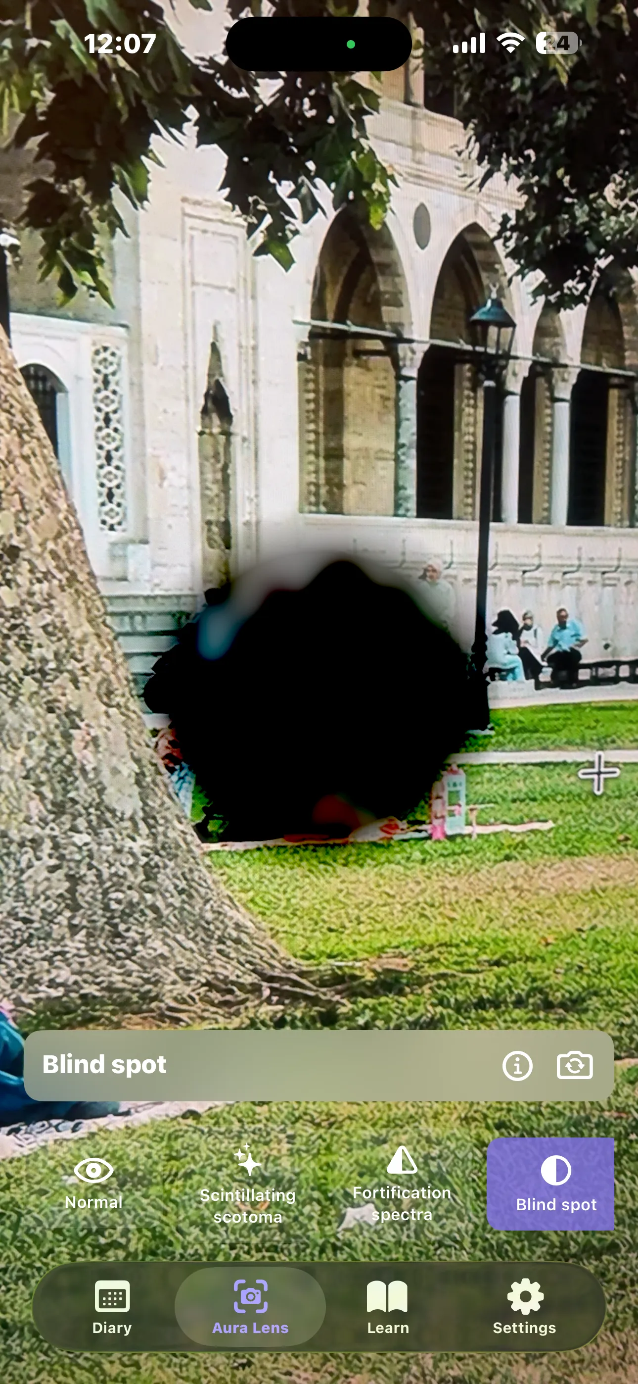 Aura Lens simulating a central blind spot — a dark scotoma obscuring the middle of the camera view