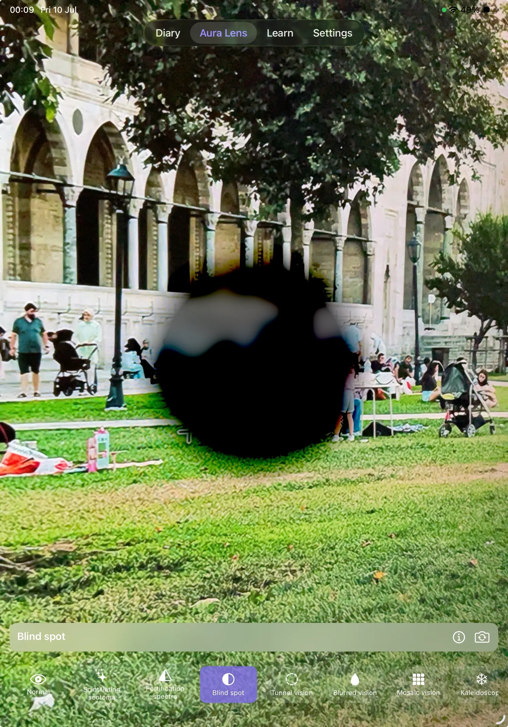 Migraine Cam on iPad — a large central blind spot covering the middle of the scene